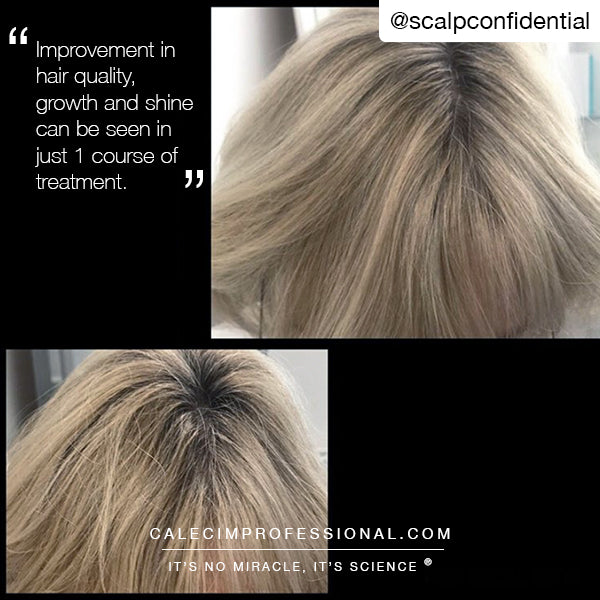 CALECIM® Professional Advanced Hair Solution 6x5ml