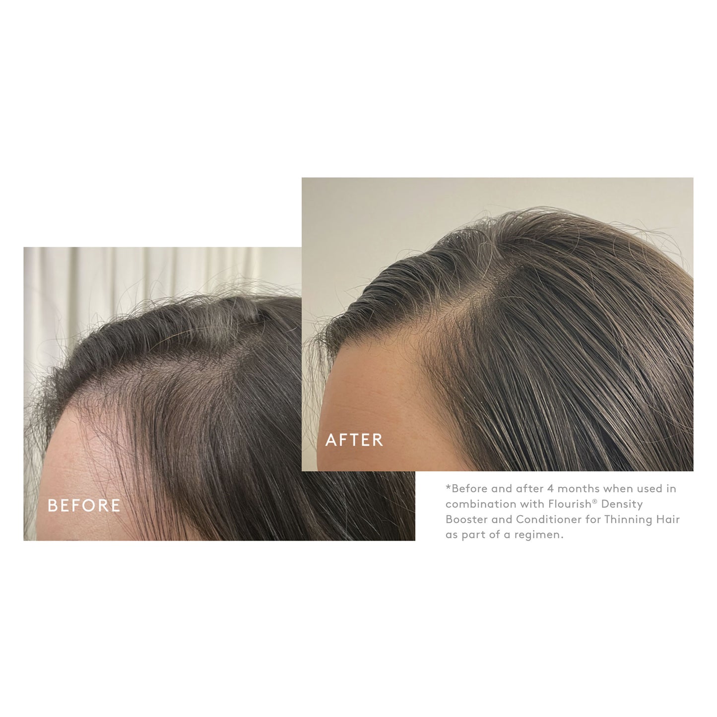 SHAMPOO FOR THINNING HAIR Detoxifies | Volumizes | Repairs