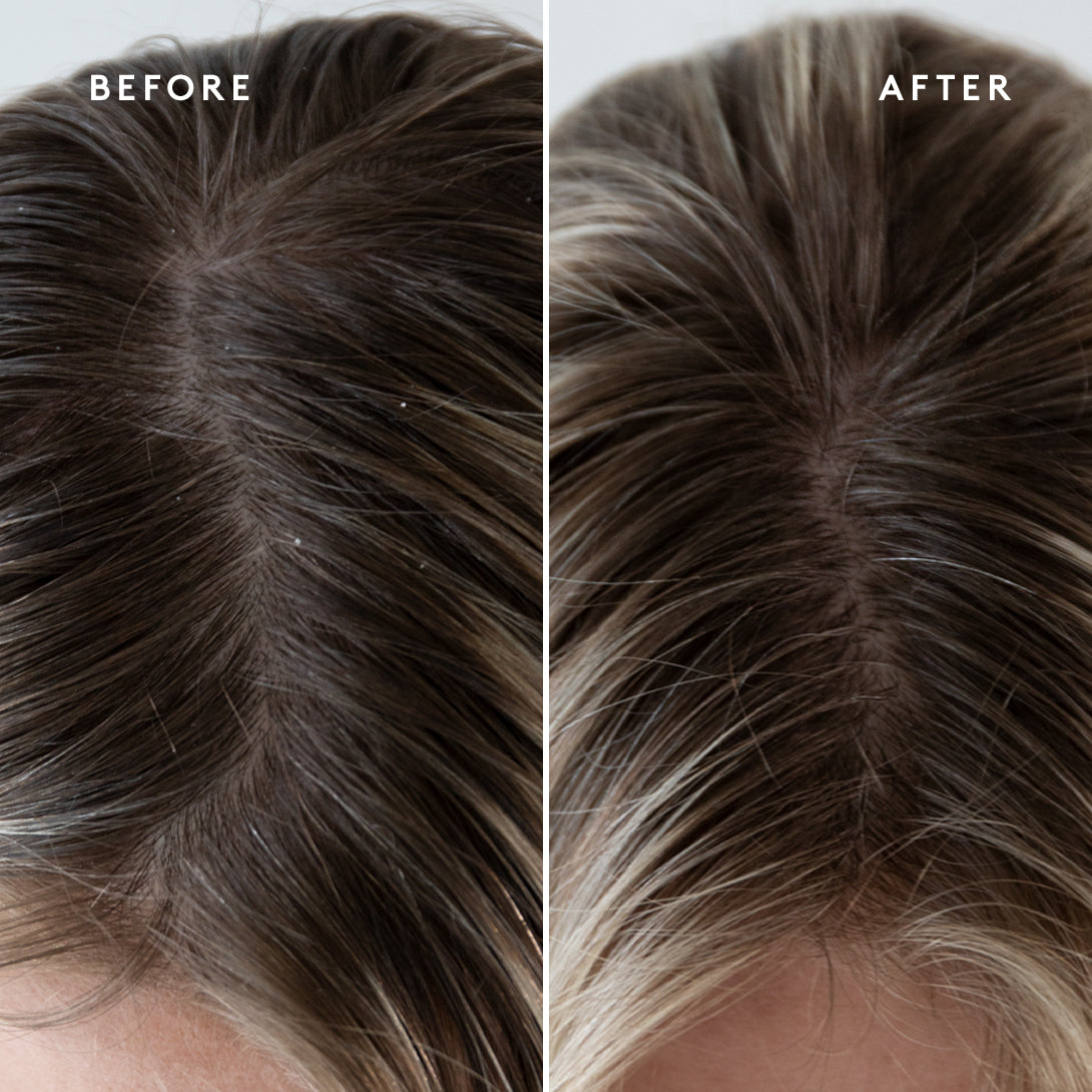 EXFOLIATING SCALP TREATMENT Detoxifies | Rebalances | Conditions