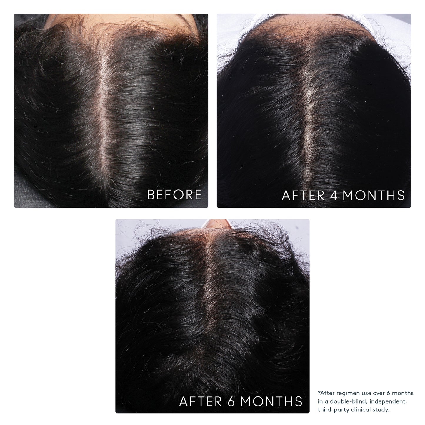 SHAMPOO FOR THINNING HAIR Detoxifies | Volumizes | Repairs